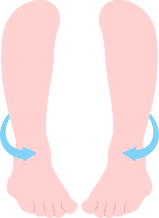 Decoding Bowed Legs Mystery and Its Hidden Causes