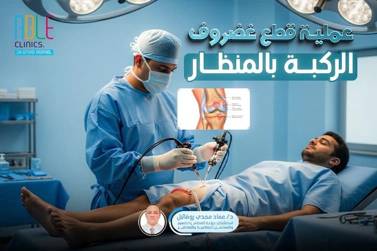 عملية قطع غضروف الركبة بالمنظار