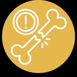 علاج كسور العظام