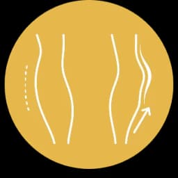 تصحيح التشوهات