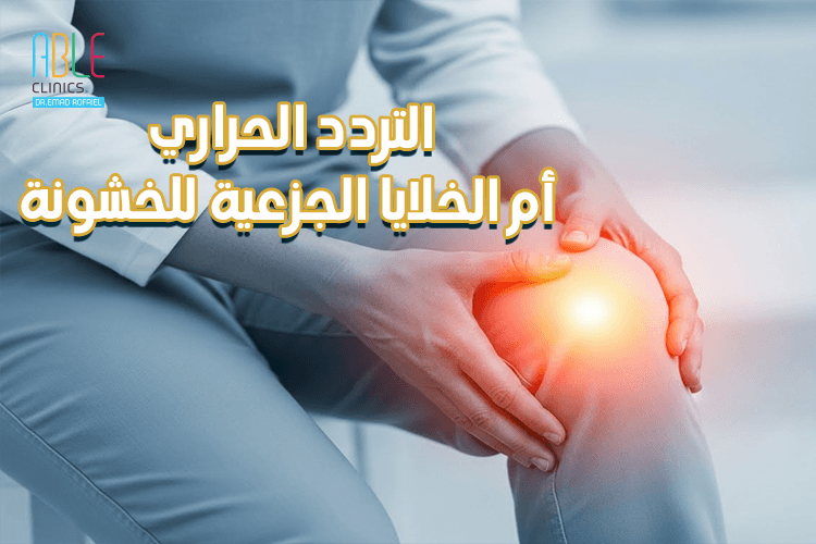 التردد الحراري أم الخلايا الجذعية؟ مقارنة لعلاج خشونة الركبة بدون جراحة