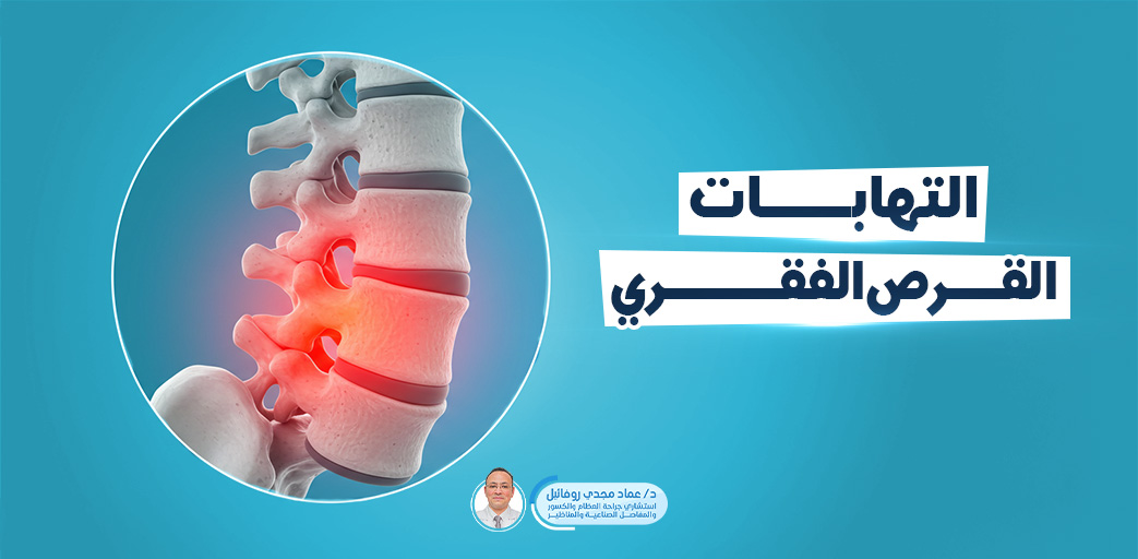 Herniated Disc: Symptoms and Treatment